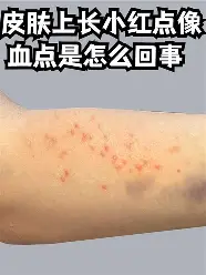 包含Uzi比分优势明显引热议的词条